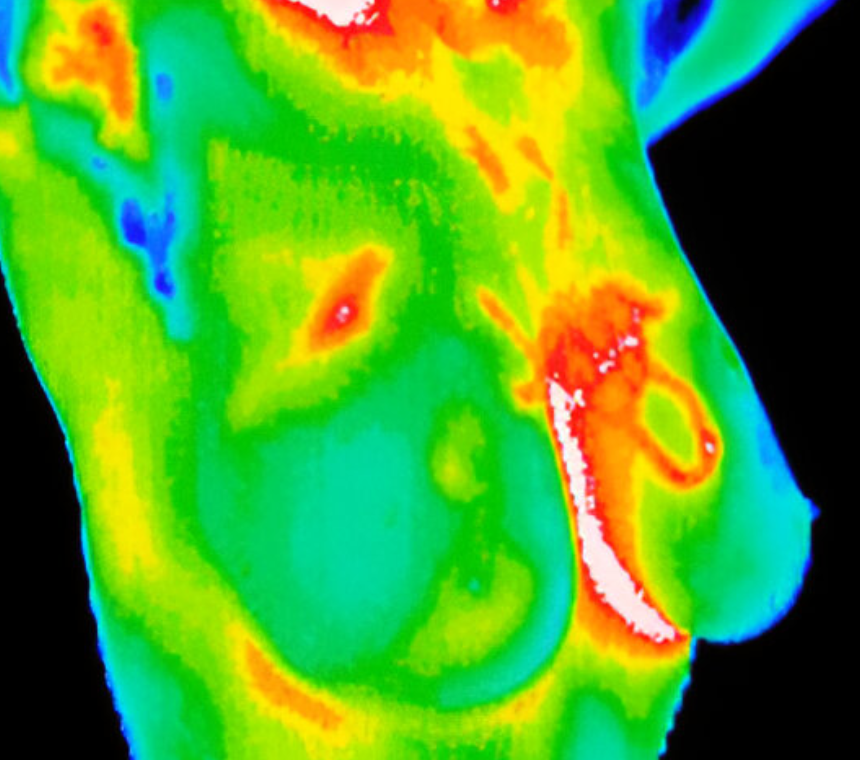 Thermography of Wisconsin