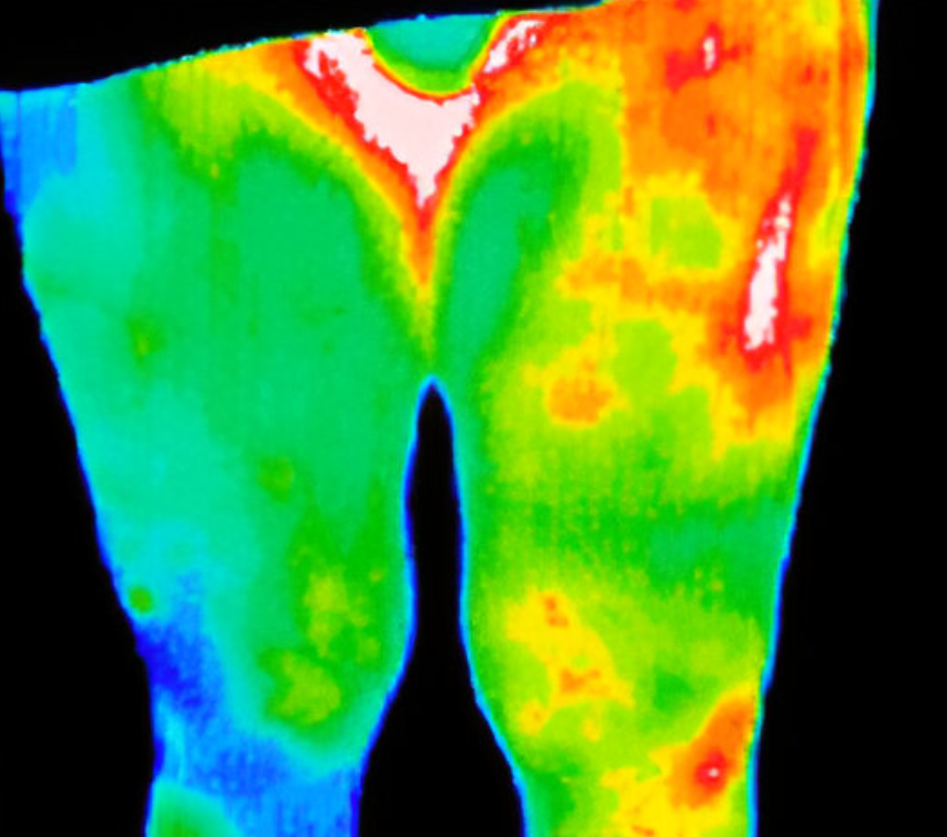 Thermography of Wisconsin